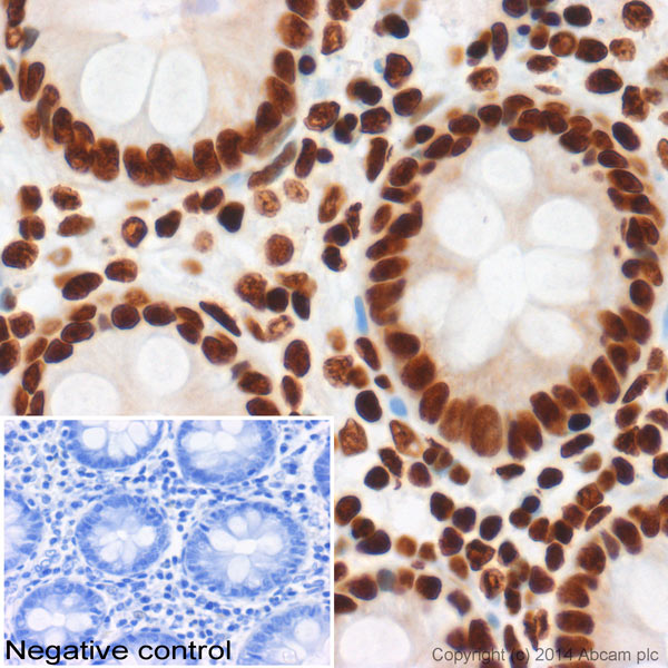 IHC image of ab4729 staining Histone H3 (acetyl K27) in normal human colon formalin-fixed paraffin-embedded tissue sections*, performed on a Leica Bond. The section was pre-treated using heat mediated antigen retrieval with sodium citrate buffer (pH6, epitope retrieval solution 1) for 20 mins. The section was then incubated with ab4729, 5µg/ml, for 15 mins at room temperature and detected using an HRP conjugated compact polymer system. DAB was used as the chromogen. The section was then counterstained with haematoxylin and mounted with DPX. No primary antibody was used in the negative control (shown on the inset).For other IHC staining systems (automated and non-automated) customers should optimize variable parameters such as antigen retrieval conditions, primary antibody concentration and antibody incubation times.*Tissue obtained from the Human Research Tissue Bank, supported by the NIHR Cambridge Biomedical Research Centre
