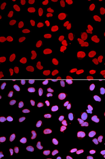 Immunocytochemistry/Immunofluorescence analysis of U2OS cells using ab185718. Blue DAPI for nuclear staining.