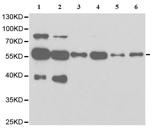 All lanes : Anti-LAP2 antibody (ab185718) at 1/500 dilutionLane 1 : Extract from 22RV1 cell line.Lane 2 : Extract from K562 cell line.Lane 3 : Extract from HepG2 cell line.Lane 4 : Extract from 293T cell line.Lane 5 : Extract from SH-SY5Y cell line.Lane 6 : Extract from H460 cell line.