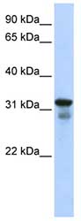 Anti-LAPTM4B antibody (ab82810) at 1 µg/ml (in 5% skim milk / PBS buffer) + 293T cell lysate at 10 µgSecondaryHRP conjugated anti-Rabbit IgG at 1/50000 dilution