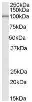 Anti-LARP2 antibody (ab62801) at 0.1 µg/ml + Human Testis lysate (35µg protein in RIPA buffer).