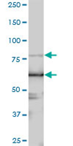 Anti-LARP4 antibody (ab70433) at 1/500 dilution + rat brain tissue lysate at 25 µgSecondaryGoat Anti-Mouse IgG (H&L)-HRP Conjugate at 1/2500 dilution