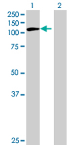 All lanes : Anti-LARP4 antibody (ab70433) at 1/500 dilutionLane 1 : LARP4 transfected 293T cell lysateLane 2 : Non-transfected 293T cell lysateLysates/proteins at 25 µg per lane.SecondaryGoat Anti-Mouse IgG (H&L)-HRP Conjugate at 1/2500 dilution