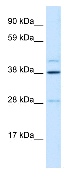 Anti-LASS3 antibody (ab28637) at 0.5 µg/ml + Foetal liver lysate 10ug.SecondaryHRP conjugated anti-Rabbit IgG 1: 50,000 - 100,000
