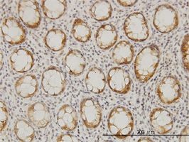 LASS6 antibody (ab56582) used in immunohistochemistry at 3ug/ml on formalin fixed and paraffin embedded human colon.