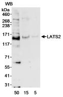 All lanes : Anti-LATS2 antibody (ab70565) at 0.4 µg/mlLane 1 : HeLa cell whole lysate at 50 µgLane 2 : HeLa cell whole lysate at 15 µgLane 3 : HeLa cell whole lysate at 5 µg