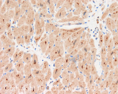 IHC image of ab110780 staining in human heart formalin fixed paraffin embedded tissue section, performed on a Leica BondTM system using the standard protocol F. The section was pre-treated using heat mediated antigen retrieval with sodium citrate buffer (pH6, epitope retrieval solution 1) for 20 mins. The section was then incubated with ab110780, 10µg/ml, for 15 mins at room temperature and detected using an HRP conjugated compact polymer system. DAB was used as the chromogen. The section was then counterstained with haematoxylin and mounted with DPX. For other IHC staining systems (automated and non-automated) customers should optimize variable parameters such as antigen retrieval conditions, primary antibody concentration and antibody incubation times.