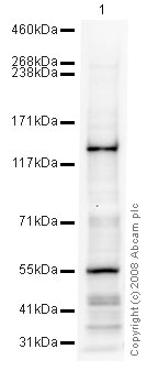 Anti-LATS2 antibody [mAbcam54073] (ab54073) at 10 µg/ml + HeLa (Human epithelial carcinoma cell line) Whole Cell Lysate at 20 µgSecondaryGoat polyclonal to Mouse IgG - H&L - Pre-Adsorbed (HRP) at 1/3000 dilutionPerformed under reducing conditions.