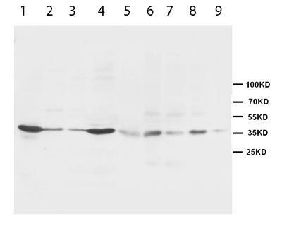 All lanes : Anti-Hex antibody (ab95438) at 1 µg/mlLane 1 : Lysate prepared from rat liver tissue.Lane 2 : Lysate prepared from rat thymus tissue.Lane 3 : Lysate prepared from rat lung tissue.Lane 4 : Lysate prepared from rat pancreas tissue.Lane 5 : Whole cell lysate prepared from HT1080 cells.Lane 6 : Whole cell lysate prepared from MM453 cells.Lane 7 : Whole cell lysate prepared from SMMC cells.Lane 8 : Whole cell lysate prepared from 6T-CEM cells.Lane 9 : Whole cell lysate prepared from Colo320 cells.