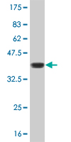 Western blot against tagged recombinant protein immunogen using ab56840 LBX1 antibody at 1ug/ml.
