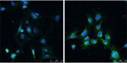 Immunofluorescence analysis of Rat brain before (left) and after (right) treatment with rapamycin (100 nm for 4 hr) labeling LC3B with ab168831 at 1/50.