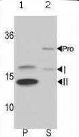 All lanes : Anti-LC3B antibody - N-terminal (ab168831) at 1/100 dilutionLane 1 : Membrane fraction of Rat brain lysateLane 2 : Soluble fraction of Rat brain lysateLysates/proteins at 12.5 µg per lane.