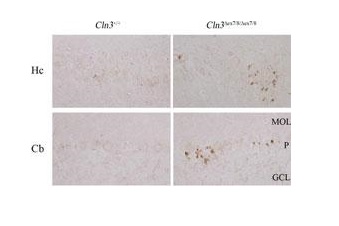 Immunohistochemical analysis of Wild-type (Cln3+/+) or homozygous Cln3Äex7/8 (Cln3Äex7/8/Äex7/8) paraffin-embedded murine brain sections labeling LC3B using ab168831 at a 1/50 dilution.KEY: CA2/CA3 region of hippocampus (Hc) and cerebellum (Cb) from 10-month-old mice. Purkinje cells (P). MOL, molecular layer; GCL, granule cell layer.
