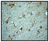 Ab51060 (1/100) staining LCAT in paraffin embedded human brain tissue by Immunohistochemistry.
