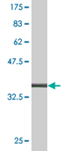 Anti-LCN1 antibody (ab76611) at 1/500 dilution + immunogen at 0.1 µgSecondaryGoat anti-mouse IgG (H&L)-HRP conjugate at 1/5000 dilution