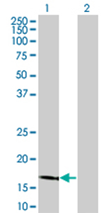 All lanes : Anti-LCN1 antibody (ab76611) at 1/500 dilutionLane 1 : LCN1 transfected 293T cell lysateLane 2 : Non-transfected 293T cell lysateLysates/proteins at 25 µg per lane.SecondaryGoat anti-mouse IgG (H&L)-HRP conjugate at 1/2500 dilution