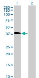 All lanes : Anti-LCN12 antibody (ab71992) at 1/500 dilutionLane 1 : LCN12 transfected 293T cell lysateLane 2 : Non transfected 293T cell lysateLysates/proteins at 25 µg per lane.SecondaryGoat anti-mouse IgG (H&L)-HRP conjugate at 1/2500 dilution