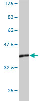 Western blot against tagged recombinant protein immunogen using ab57945 LDHAL6B antibody at 1ug/ml.