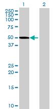 All lanes : Anti-LDHD antibody (ab72926) at 1/500 dilutionLane 1 : 293T lysate - transfected with LDHDLane 2 : 293T lysate - non-transfectedLysates/proteins at 25 µg per lane.SecondaryGoat Anti-Mouse IgG (H&L)-HRP Conjugate at 1/2500 dilution