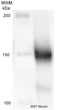 Anti-LDL Receptor antibody (ab14056) at 1/5000 dilution + CHO-cells transfected with human LDLR at 20 µgSecondaryGoat Anti-Chicken IgY H&L (HRP) (ab6877) at 1/2000 dilutiondeveloped using the ECL techniquePerformed under reducing conditions.Observed band size : 120,150 kDa (why is the actual band size different from the predicted?)Exposure time :  2 minutesThis image is courtesy of an anonymous AbreviewSee Abreview