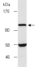 Anti-LDL Receptor antibody (ab134998) at 1/1000 dilution + HepG2 total cell extract