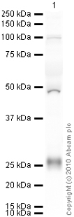 Anti-LDL Receptor antibody [EP1553Y] (ab52818) at 1/500 dilution + Human Plasma Total Protein Lysate at 10 µgSecondaryGoat Anti-Rabbit IgG H&L (HRP) preadsorbed (ab97080) at 1/5000 dilutiondeveloped using the ECL techniquePerformed under reducing conditions.