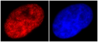 SK-N-SH cells fixed in 4% paraformaldehyde, permeabilized in 0.5% Triton X-100 and incubated for 1 hour with ab12179 (1/1000 dilution). ab12179 staining is localized to the nucleus (red). The cells were counterstained with DAPI (blue). 100x magnification.