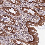 ab122866 at 1/1000 dilution staining LEKR1 in paraffin-embedded Human rectum tissue by Immunohistochemistry.