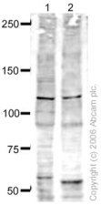 All lanes : Anti-LEO1 antibody (ab33157) at 1 µg/mlLane 1 : HeLa (Human epithelial carcinoma cell line) Whole Cell LysateLane 2 : Jurkat (Human T cell lymphoblast-like cell line) Whole Cell Lysate (ab7899)Lysates/proteins at 20 µg per lane.SecondaryGoat polyclonal to Rabbit IgG (Alexa Fluor® 680) at 1/10000 dilutiondeveloped using the ECL technique
