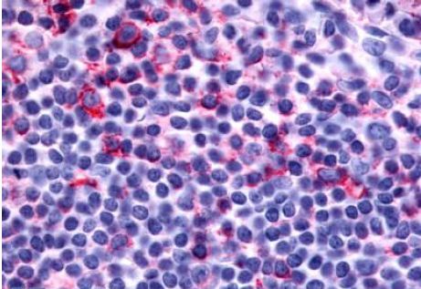 Immunohistochemical analysis of formalin-fixed, paraffin embedded Human tonsil tissue labelling Leukotriene B4 Receptor 2 with ab140835 at 12 μg/ml.