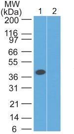 All lanes : Anti-Leukotriene B4 Receptor antibody (ab129337) at 3 µg/mlLane 1 : Lysate from Human muscle Lane 2 : Lysate from Human muscle with immunizing peptide developed using the ECL technique