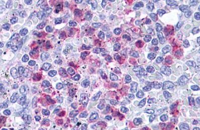 Immunohistochemical analysis of formalin-fixed, paraffin-embedded Human spleen tissue (red pulp) labelling Leukotriene B4 Receptor with ab140832 at 4 μg/ml.