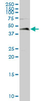 Anti-Leupaxin antibody (ab67571) at 1/500 dilution + human spleen tissue lysate at 25 µgSecondaryGoat Anti-Mouse IgG (H&L)-HRP Conjugate at 1/2500 dilution