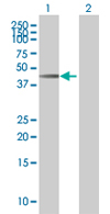 All lanes : Anti-Leupaxin antibody (ab67571) at 1/500 dilutionLane 1 : Leupaxin transfected 293T cell lysateLane 2 : Non-transfected 293T cell lysateLysates/proteins at 25 µg per lane.SecondaryGoat Anti-Mouse IgG (H&L)-HRP Conjugate at 1/2500 dilution
