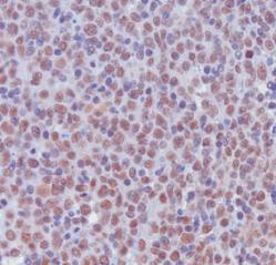 ab8284 was used in immunohistochemistry with paraffin embedded sections of human tonsil, using DAB as a chromogen (brown). Counterstaining of nuclei was performed with haemotoxylin (blue).Staining is seen confined to the nucleus.