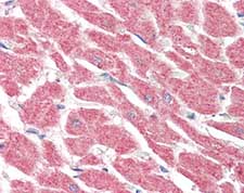 ab115305, at 5µg/ml, staining Lgi4 in formalin-fixed, paraffin-embedded Human Heart tissue by Immunohistochemistry, using a biotinylated goat anti-rabbit IgG secondary antibody, alkaline phosphatase-streptavidin and chromogen.