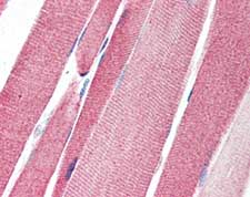 ab115305, at 5µg/ml, staining Lgi4 in formalin-fixed, paraffin-embedded Human Skeletal Muscle tissue by Immunohistochemistry, using a biotinylated goat anti-rabbit IgG secondary antibody, alkaline phosphatase-streptavidin and chromogen.