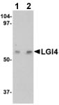 Lane 1 : Anti-Lgi4 antibody (ab115305) at 1 µg/mlLane 2 : Anti-Lgi4 antibody (ab115305) at 2 µg/mlLane 1 : Human brain tissue lysateLane 2 : Human brain tissue lysate