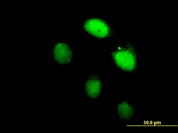 Immunofluorescence analysis of paraformaldehyde-fixed HeLa cells, labeling Lhx4 using purified ab168224 at 10 µg/ml. Note: this antibody was purified prior to use with this application.