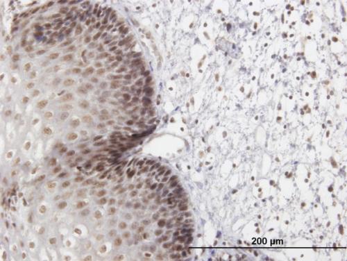 Immunohistochemical analysis of formalin-fixed paraffin-embedded Human esophagus tissue, labeling Lhx4 using purified ab168224 at 3 µg/ml. Note: this antibody was purified prior to use with this application.