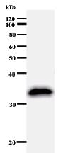 Anti-Lhx4 antibody [LHX4E11E10] (ab50790) + Immunised recombinant protein.