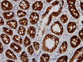 LI Cadherin antibody (ab54511) used in immunohistochemistry at 3ug/ml on formalin fixed and paraffin embedded human small Intestine.
