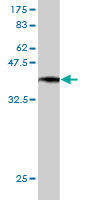 Western blot against tagged recombinant protein immunogen using ab54511 LI Cadherin antibody at 1ug/ml.
