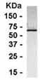 Anti-LI Cadherin antibody (ab37788) at 1/2000 dilution + E. coli derived fusion protein at 2.5 µgSecondaryHRP conjugated Goat anti IgY at 1/1000 dilution