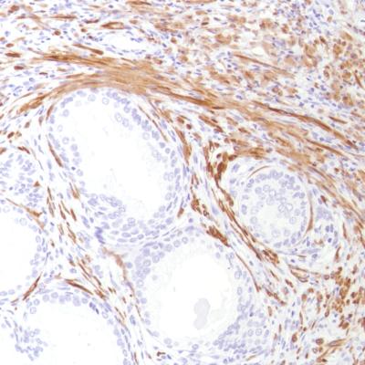 Immunohistochemical analysis of Human prostate tissue labeling LI Cadherin using ab183318 at a 1/100 dilution