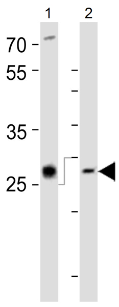 All lanes : Anti-LIF antibody (ab135629) at 1/1000 dilutionLane 1 : PC-12 cell lysateLane 2 : Mouse spleen tissue lysateLysates/proteins at 20 µg per lane.SecondaryHRP-conjugated goat anti-rabbit IgG (H+L) at 1/10000 dilution