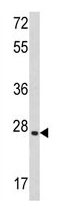 Anti-LIF antibody (ab135629) at 1/1000 dilution + CEM cells lysate at 35 µgSecondaryHRP goat anti-rabbit (H+L) at 1/5000 dilution