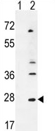 All lanes : Anti-LIF antibody (ab135629) at 1/100 dilutionLane 1 : Nontransfected 293 cell lysates Lane 2 : lysate of 293 cells transiently transfected with the LIF gene Lysates/proteins at 2 µg per lane.