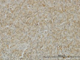 LIGHT antibody (ab57901) used in immunohistochemistry at 3ug/ml on formalin fixed and paraffin embedded human spleen.