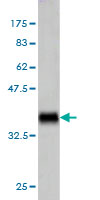 Western blot against tagged recombinant protein immunogen using ab57901 LIGHT antibody at 1ug/ml.
